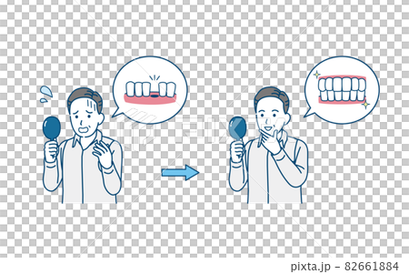 歯が抜けて困る中年の男性　ミドル　差し歯が取れる　ビフォーアフター　イラスト素材 82661884
