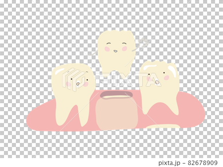 Regeneration of teeth: Teeth that look at the deciduous teeth that come out and the permanent teeth that are likely to grow 82678909