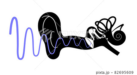 Tinnitus disease concept Tinnitus disease concept 82695609