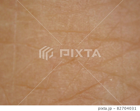 荒れ気味の肌の表面 荒れ気味の肌の表面 82704031