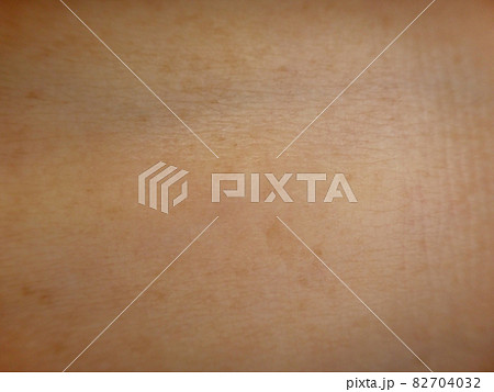 荒れ気味の肌の表面 82704032