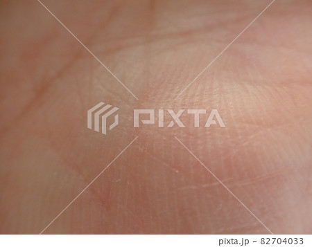 手のひらの皮膚の接写 手のひらの皮膚の接写 82704033