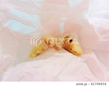 背景 歯 歯科医 82706858