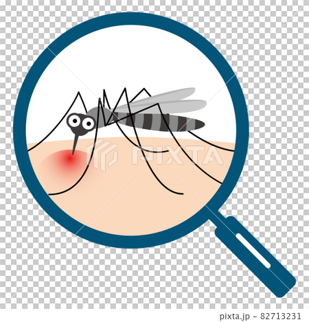Enlarge blood-sucking mosquitoes with a loupe Cartoon-style vector illustration 82713231