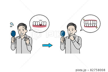 歯が抜けて困る中年の男性 ミドル 差し歯が取れる ビフォーアフター イラスト素材 歯が抜けて困る中年の男性 ミドル 差し歯が取れる ビフォーアフター イラスト素材 82758008