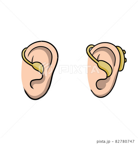 Hearing aid. Hearing problems and disabilities. Set of Cartoon illustration Hearing aid. Hearing problems and disabilities. Set of Cartoon illustration 82780747
