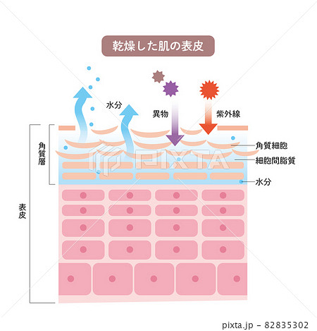 乾燥した肌の表皮 皮膚の構造 肌図 美容のイラスト素材 5302