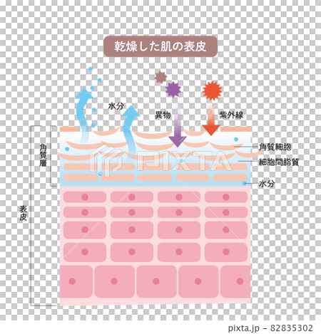 乾燥した肌の表皮　皮膚の構造　肌図　美容 82835302