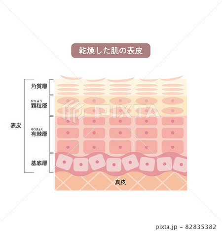 乾燥した肌の表皮 皮膚の構造 肌図 美容のイラスト素材 53