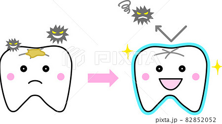 フッ素塗布をして虫歯予防のイラスト素材 8552