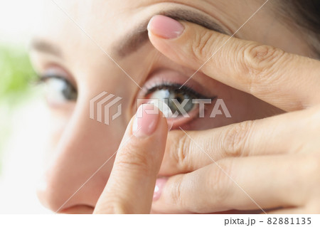 Woman puts on soft contact lens over eyes closeup Woman puts on soft contact lens over eyes closeup 82881135
