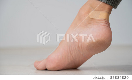 A woman seals a corn on her leg with a plaster. The girl rubbed her leg with uncomfortable shoes. 82884820