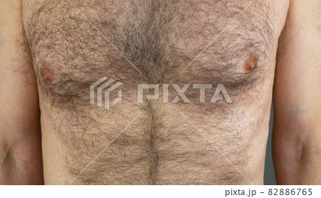A man with a hairy male breast close-up. Long chest hair A man with a hairy male breast close-up. Long chest hair 82886765