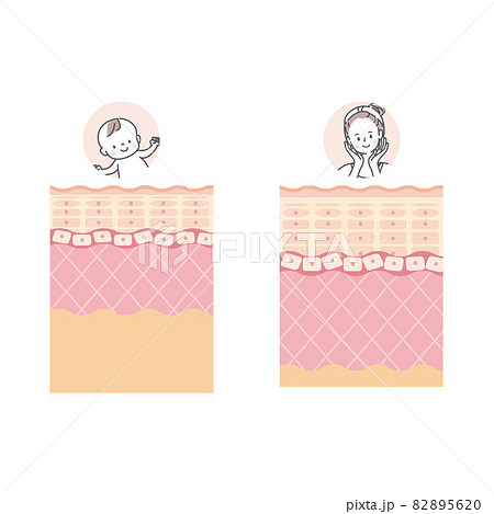 赤ちゃんと大人の肌の違い 皮膚の構造 肌図のイラスト素材 56