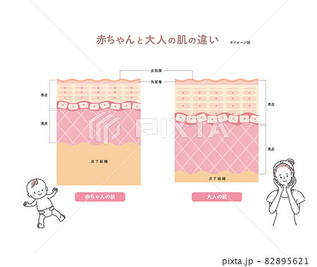 赤ちゃんと大人の肌の違い　皮膚の構造　肌図 82895621