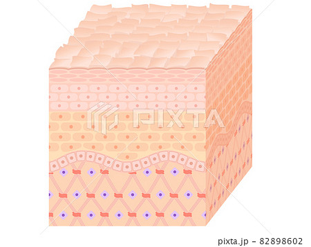 肌断面（乾燥肌） 82898602
