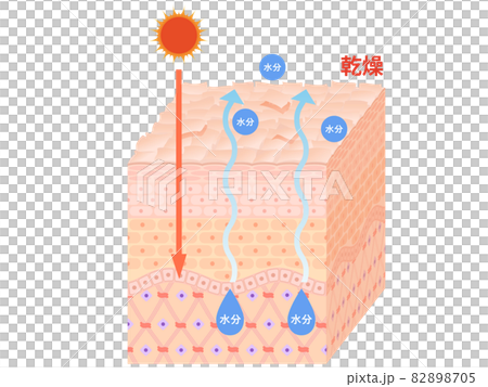 Skin cross section (dry skin) 82898705