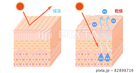 肌断面(乾燥肌) 肌断面(乾燥肌) 82898716