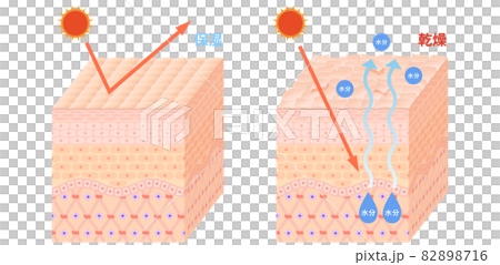 肌断面(乾燥肌) 肌断面(乾燥肌) 82898716