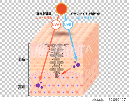 皮膚橫截面（印跡） 82899427