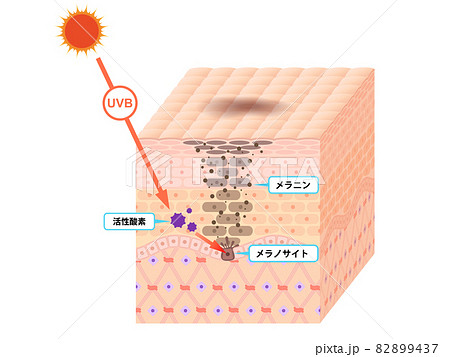 肌断面(しみ) 肌断面(しみ) 82899437