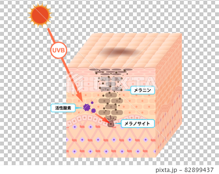 肌断面(しみ) 肌断面(しみ) 82899437
