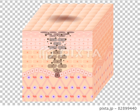 Skin cross section (blot) Skin cross section (blot) 82899440