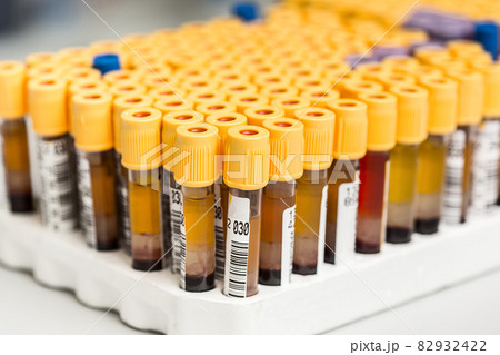 Test-tubes with yellow liquid in the laboratory Test-tubes with yellow liquid in the laboratory 82932422