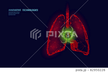 3D human lungs medicine toxicity research concept. Respiratory virus infection cancer danger analysis. Therapy of tuberculosis hospital poster vaccine template vector illustration 82950226