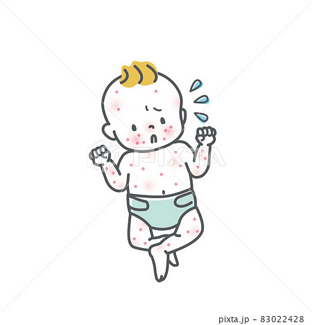 肌荒れしている赤ちゃんのイラスト素材 肌荒れしている赤ちゃんのイラスト素材 83022428