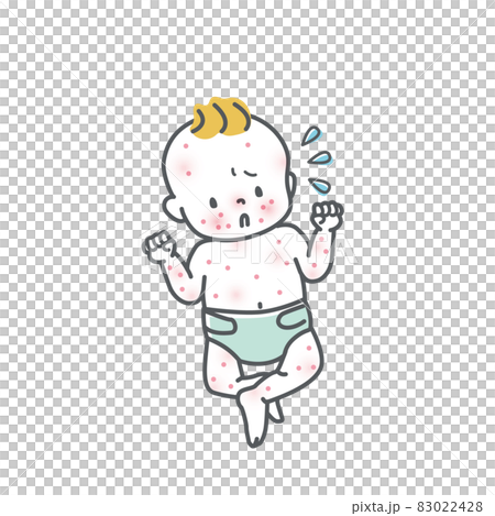 肌荒れしている赤ちゃんのイラスト素材 肌荒れしている赤ちゃんのイラスト素材 83022428