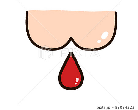 お尻から出血 83034223