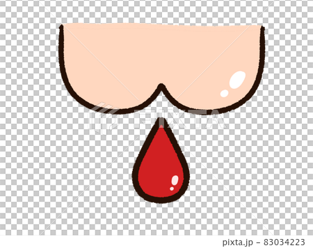 お尻から出血 83034223