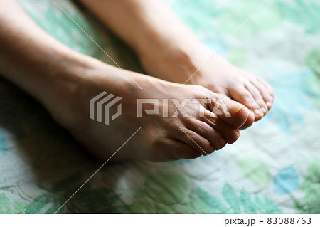 介護用ベッドに横たわる高齢女性の足元のアップ 83088763