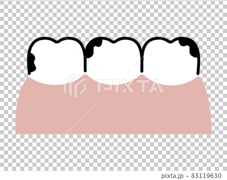 齲齒/臟牙（一字排開）/簡單畫線 83119630