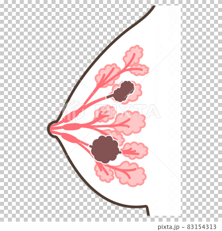 乳腺癌圖 83154313