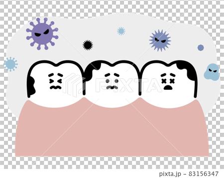 充滿蛀牙和真菌的口腔環境 83156347