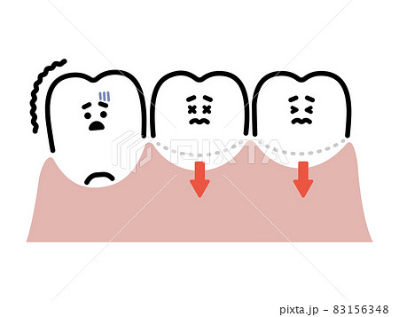 歯茎下がり／抜けそうな歯　キャラクター 83156348