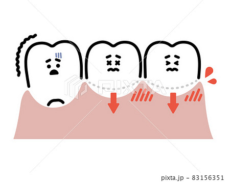 歯茎下がり／抜けそうな歯／歯肉の炎症　キャラクター 83156351