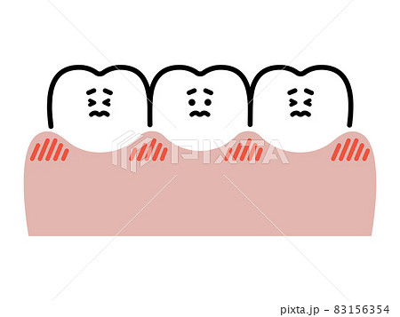 赤く腫れた歯茎と歯 キャラクター 赤く腫れた歯茎と歯 キャラクター 83156354
