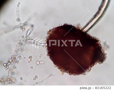 黒カビの胞子 83165222