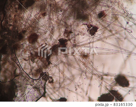 カビの顕微鏡写真 83165330