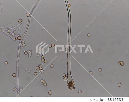 カビの頂のう 83165334