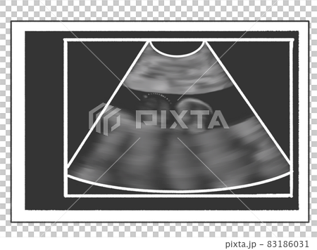 エコー写真風のイラスト 妊娠5か月(18週ごろ) エコー写真風のイラスト 妊娠5か月(18週ごろ) 83186031