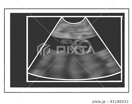 エコー写真風のイラスト（妊娠16週） 83186032