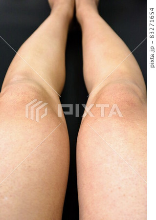 脱毛した日本人男性の脚 脱毛した日本人男性の脚 83271654