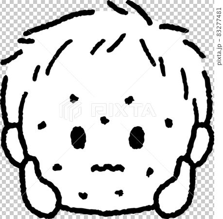 Illustration of a boy with a rash Illustration of a boy with a rash 83277481
