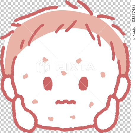 Illustration of a boy with a rash Illustration of a boy with a rash 83277482