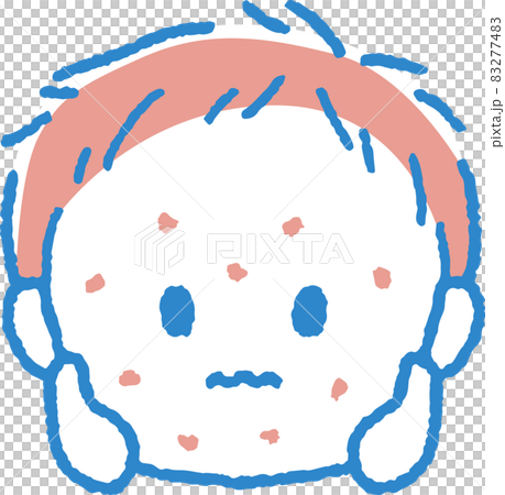 Illustration of a boy with a rash 83277483