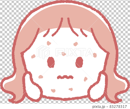 湿疹が出た女の子のイラスト 湿疹が出た女の子のイラスト 83278317